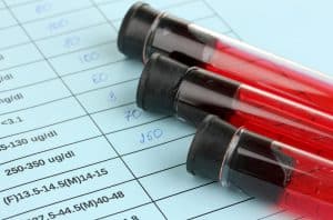 5 Ways to Beat a DWI/DUI in Ocean County, NJ by Challenging a Blood Test