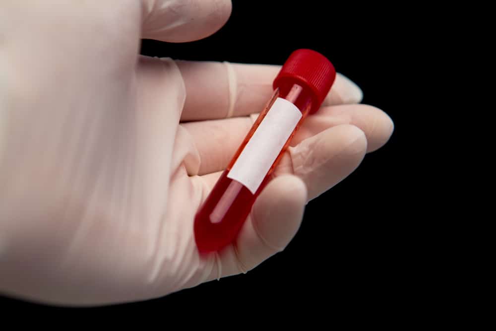 5 Ways to Fight a Blood Test in a DWI/DUI Charge in New Jersey